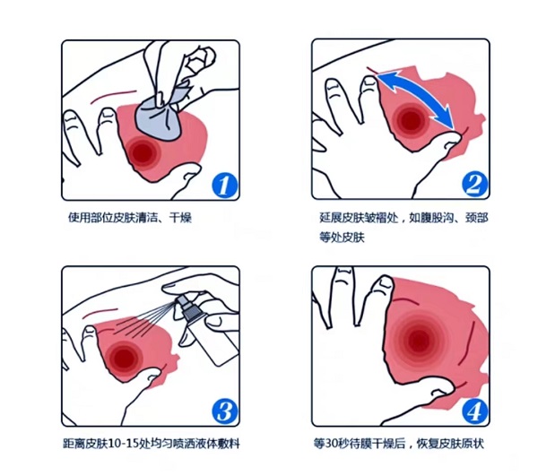 液体绷带